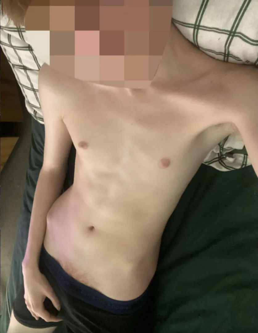 Ginger pits, pubes and hair posted by Altruistic_Ad_5278