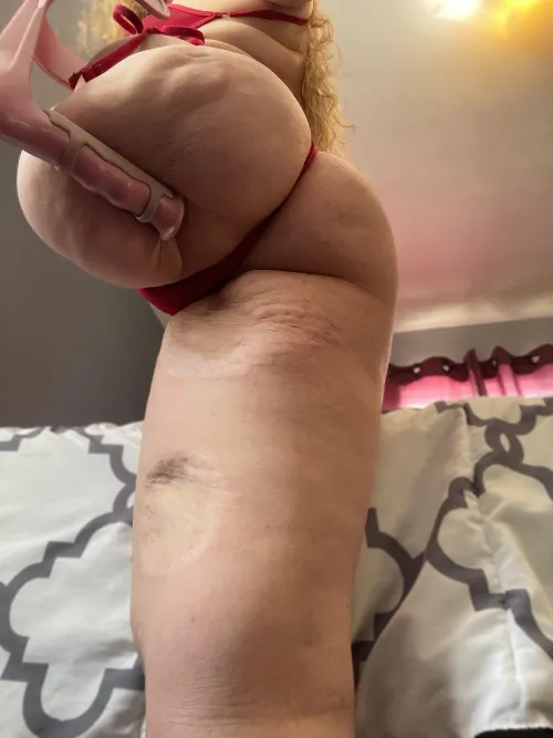 Good morning from your favorite HAG (Hip Amputee Goddess). May your day be finer than my ass by Artemis_Is_back