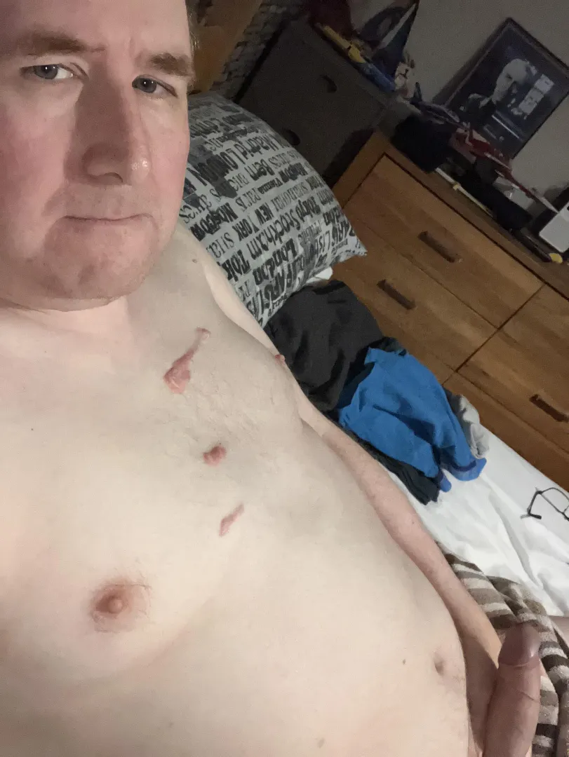 Good morning M43 Muscular Dystrophy posted by Elementalginger