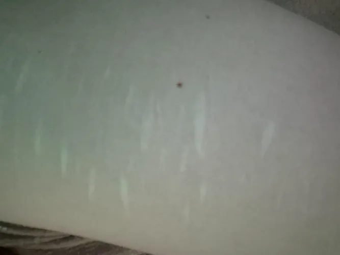 Guess the body part by saraonly420