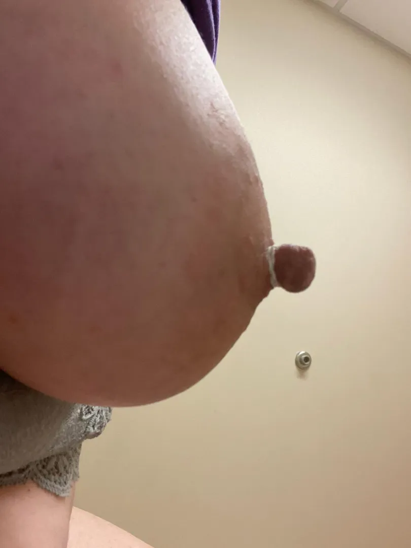 Gumdrop in a rubber band posted by Frisky_Vanilla