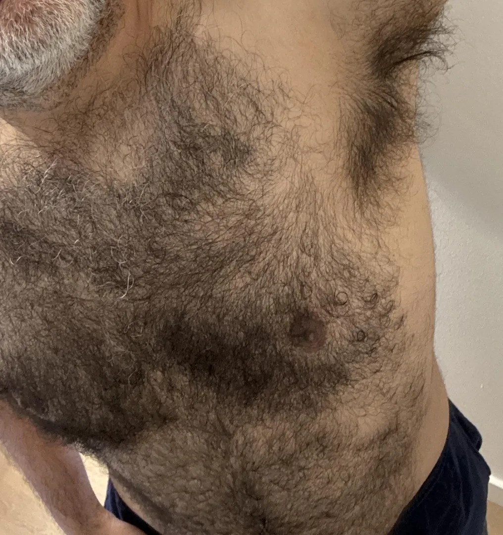 Hairy Mexican guy posted by Flat-Ferret-2104