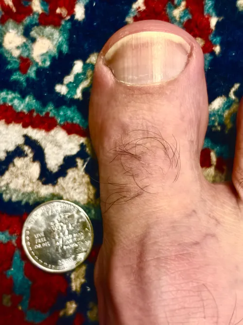 Hairy toe by _y_r_t_