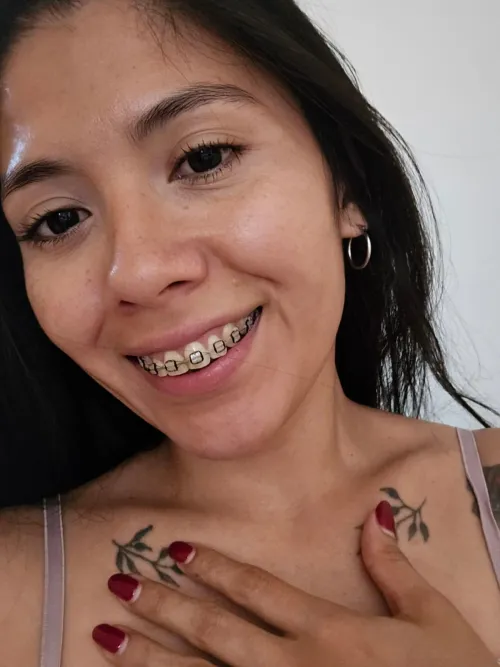 Happy Thursday! Kissing with braces is so nice! by Rufinitavip