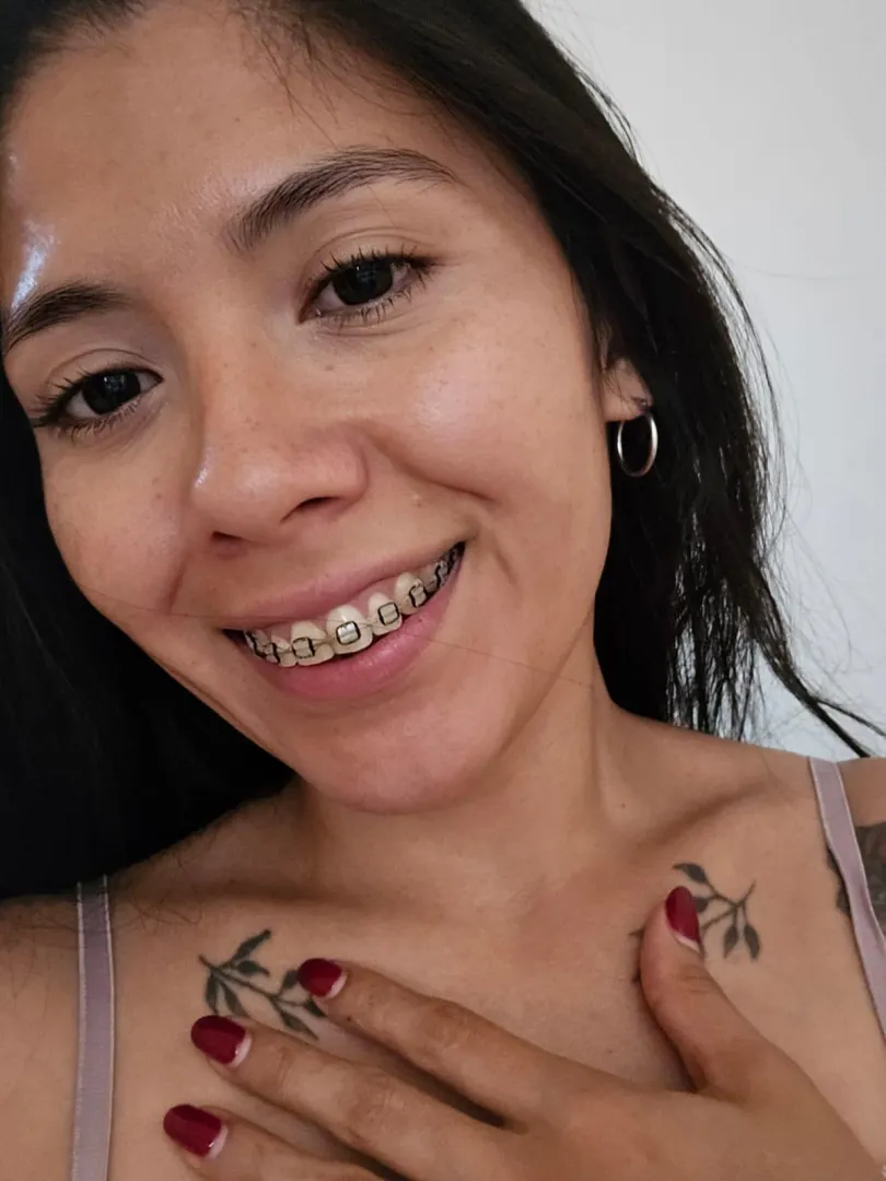 Happy Thursday! Kissing with braces is so nice! posted by Rufinitavip