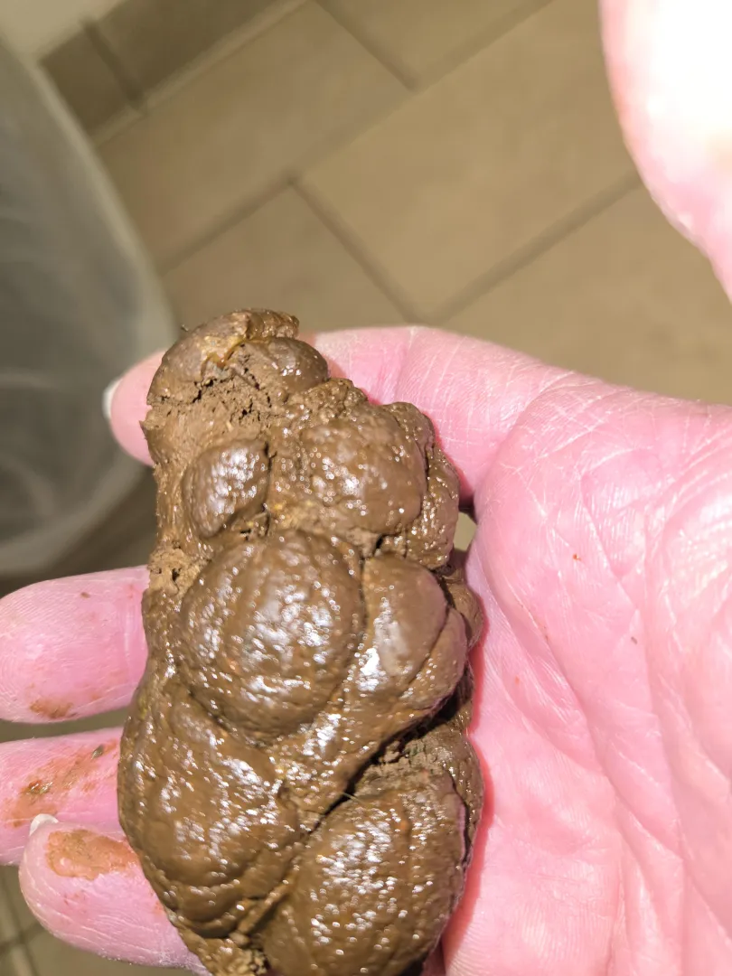 Hard turd posted by Historical_Delay4158