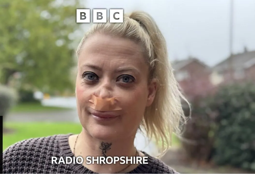 Her “Turkey Teeth” caused her nose to collapse. posted by TimeWasting_Fun