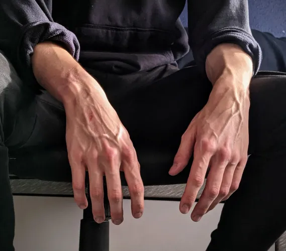 Hey Reddit  by Chigurh67