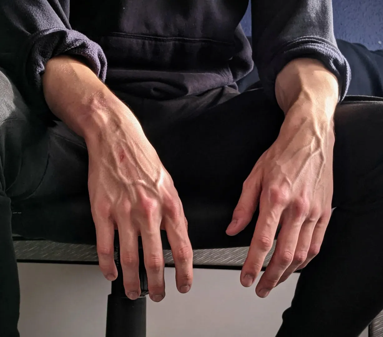 Hey Reddit  posted by Chigurh67