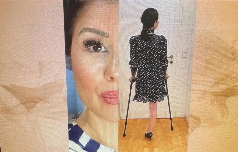 Hi do you know Farina? a dream Amputeelady, you can visit my web amputeelady.de and write me to kontakt@amputeelady .de by Both_Target_5277