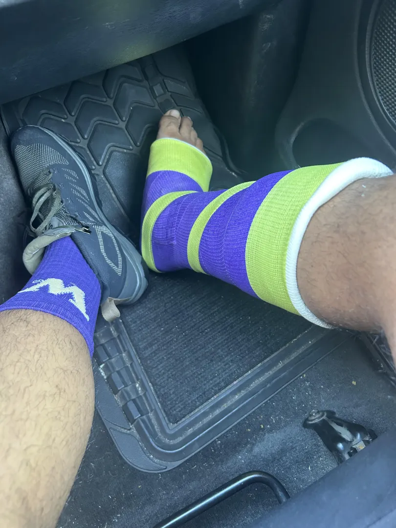 Hiking boots and a cast because of a broken ankle…free toes m22(at time of pic) posted by No_Piano8417