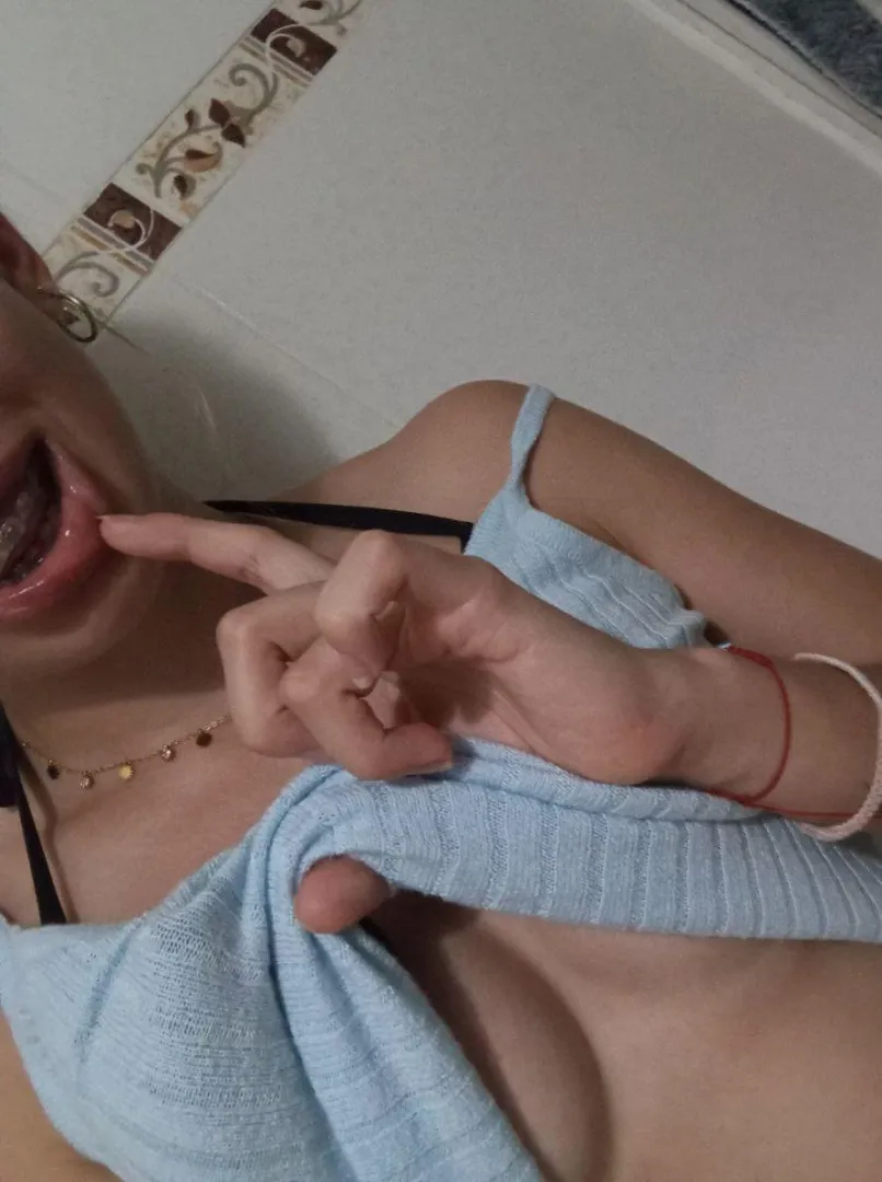 Hope you like my braces posted by SilkStormz