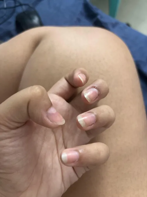 how to stop nail biting and cuticle picking? by ParsnipSimple3724
