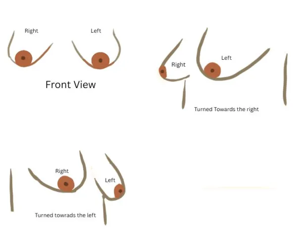 I Can't Tell if My Boobs Are Constricted by Round_Out207