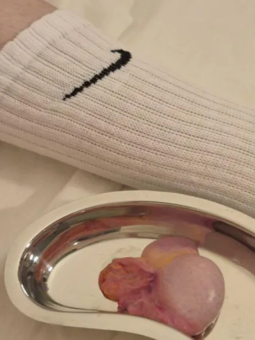 I didn't deserve this bull testicle by DueAside8495