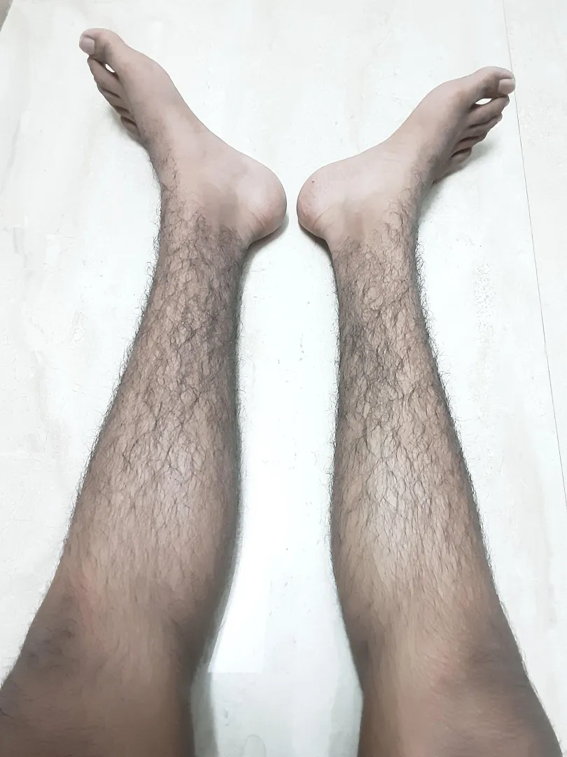 I didn't expect to develop hair on my legs before my arms, face and chest[18 M]... posted by Gloomy_Ad9609