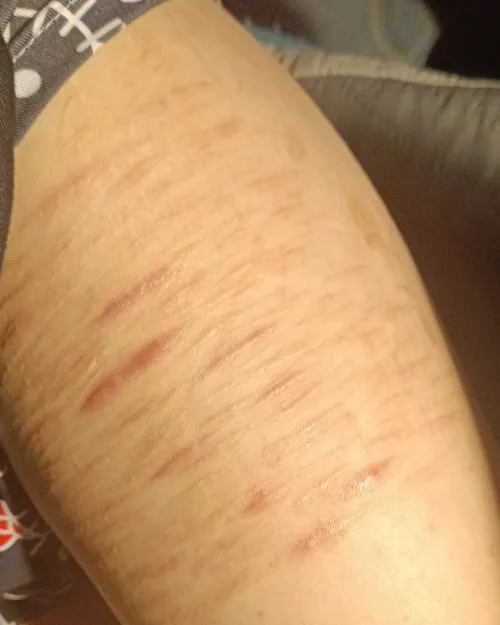 i hate them and love them at once by Electrical_Cherry539