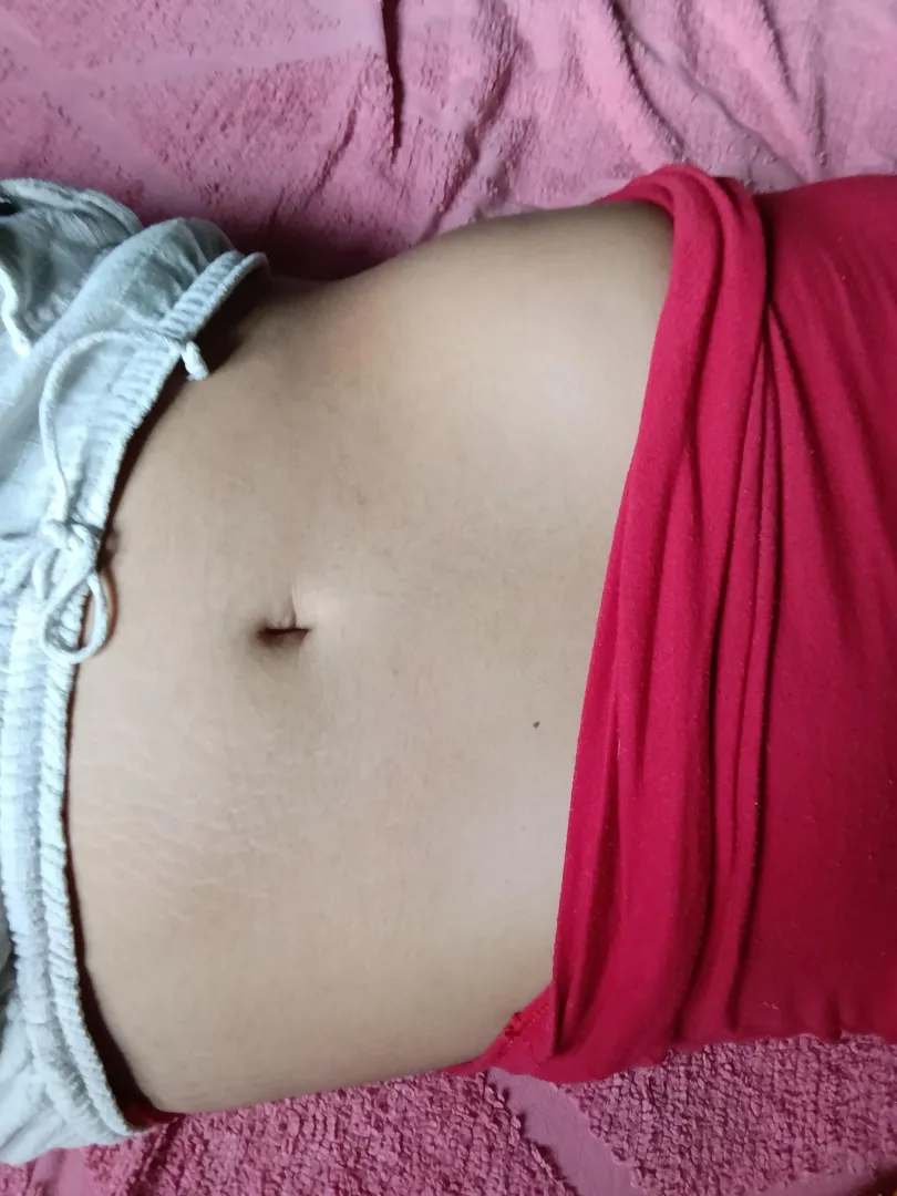 I have a lot of stretch marks here posted by softncuteee