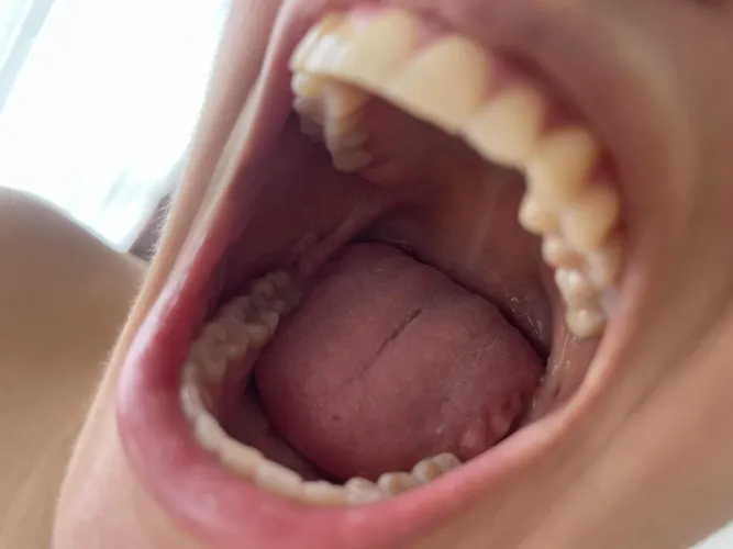 I know you're eager for me to devour you and let my stomach acid dissolve you , right {?} by Yayita1411