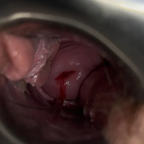 i loooove love love how she’s looking these days  (cw for period blood) by bonekeys