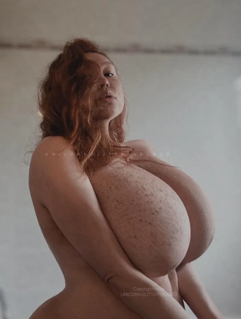 I love my freckles! posted by Unicornglitteryblood