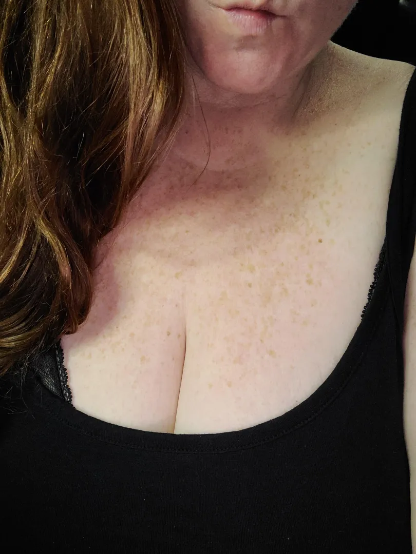 I love my freckles! posted by Lynn-Ryder