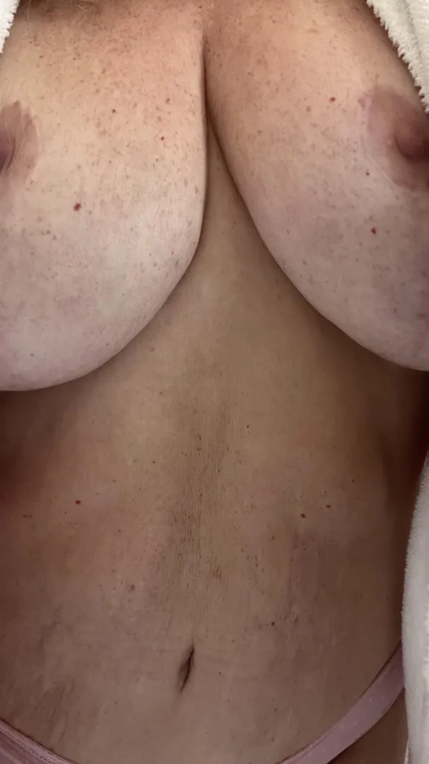 I love my freckles! posted by huninoir