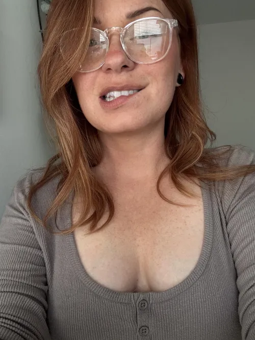 I love my freckles! by freckledjedii