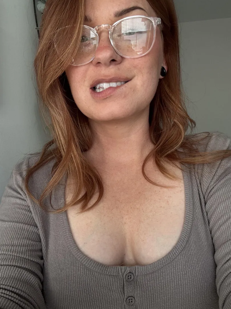 I love my freckles! posted by freckledjedii