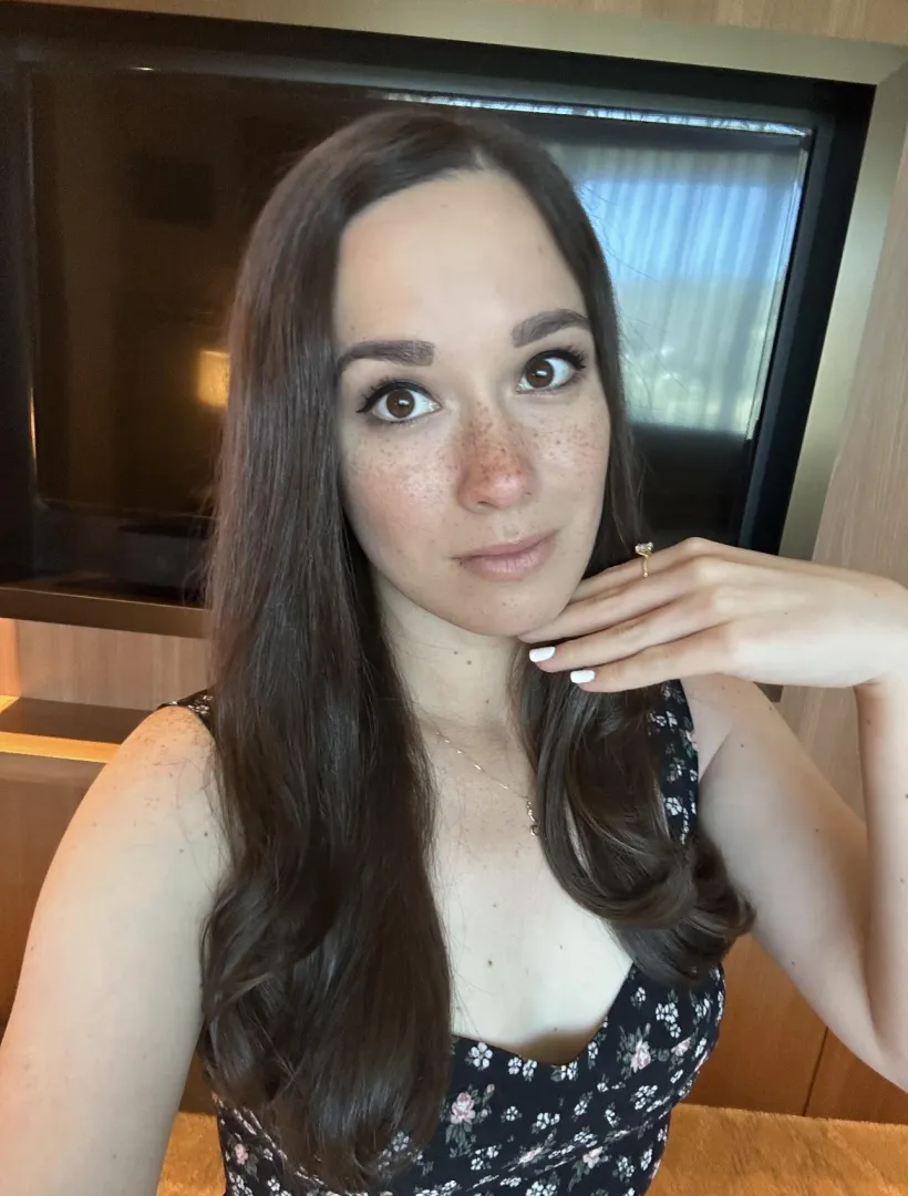 I love my freckles! posted by AlanaAraya