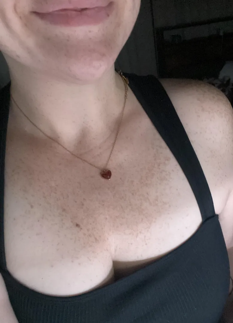 I love my freckles! posted by marroonedAstronaut3