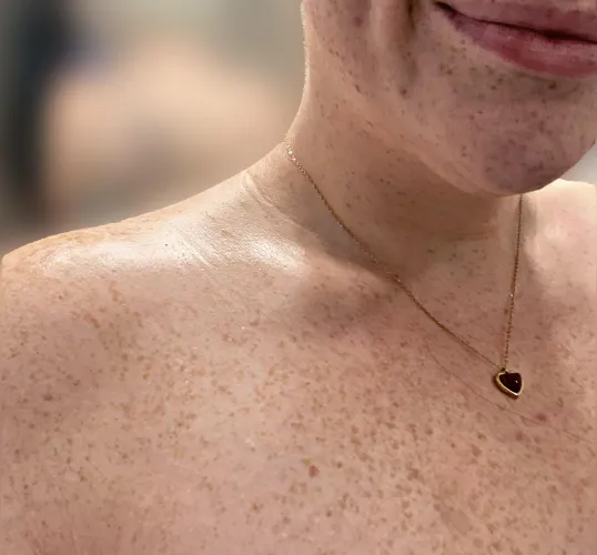 I love my freckles! by marroonedAstronaut3