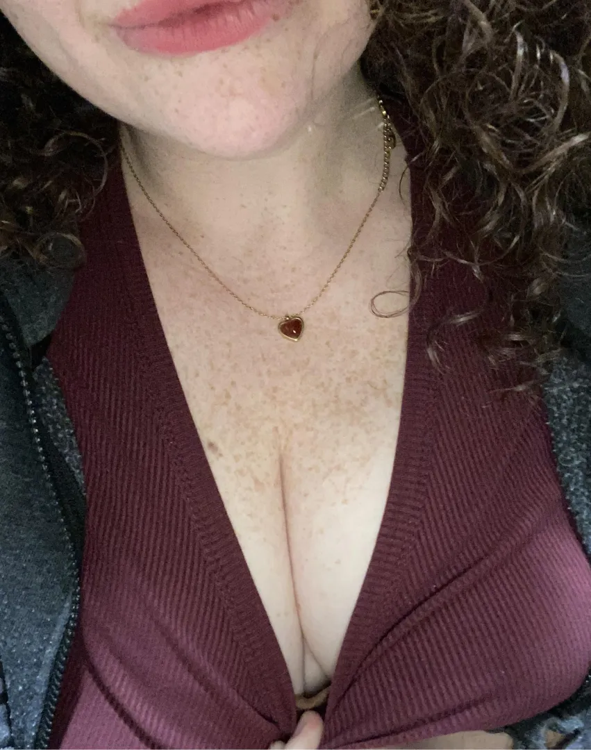 I love my freckles! posted by marroonedAstronaut3