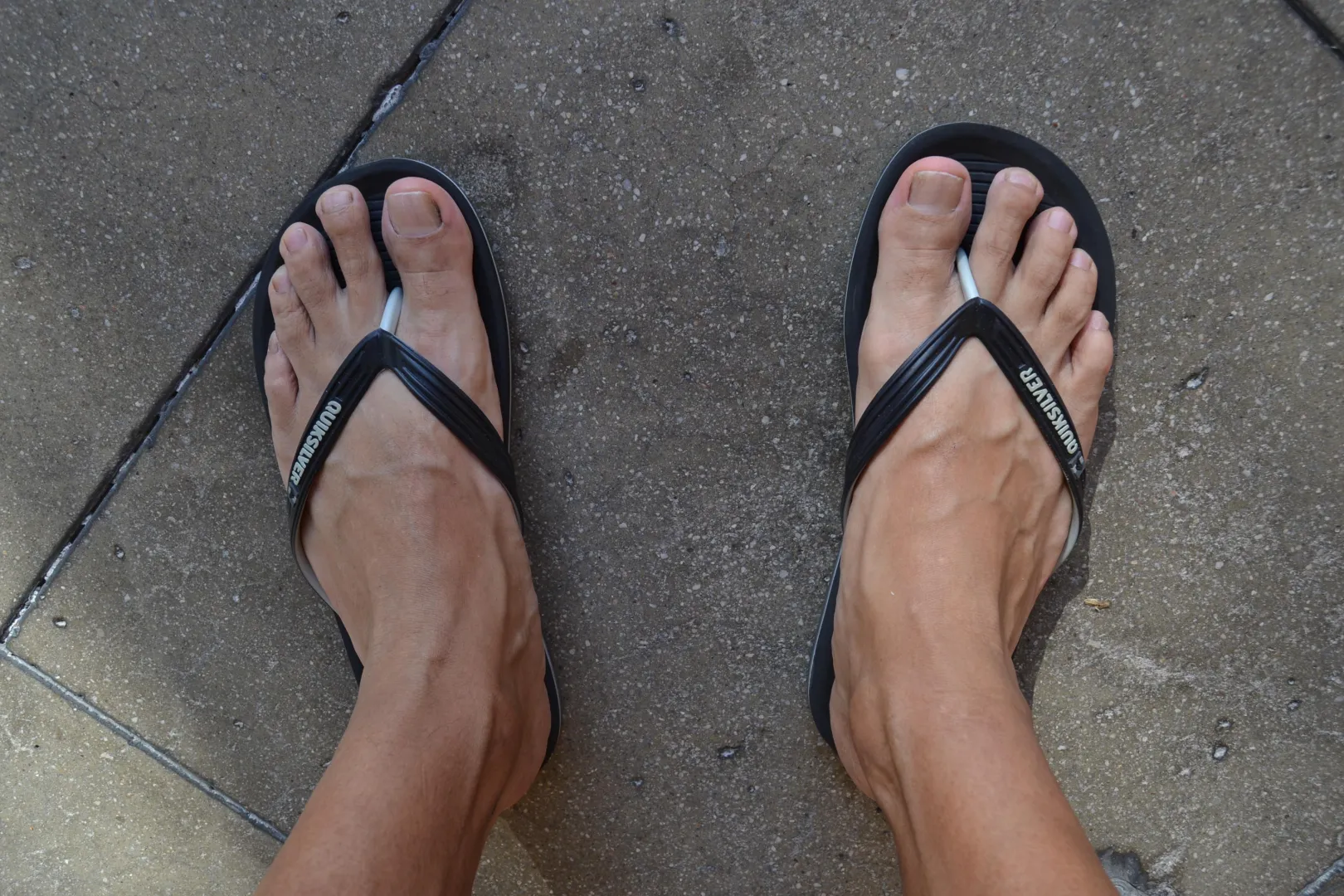 i love showing my feet. You like them? posted by Hairy-Item-1118