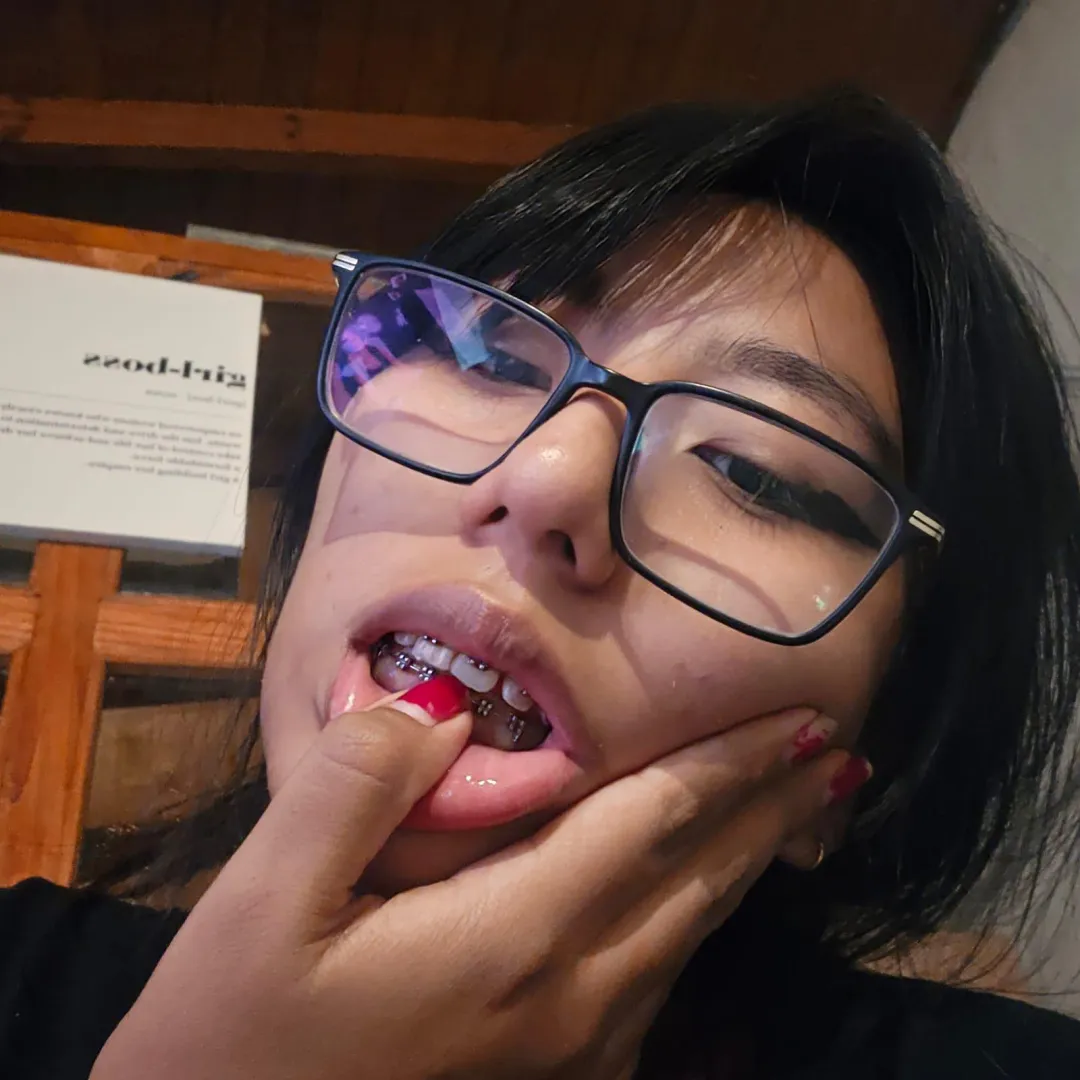 i love the way the cold steel of my braces feels while i am whispering exactly how i am going to use you posted by Virtualuuxx