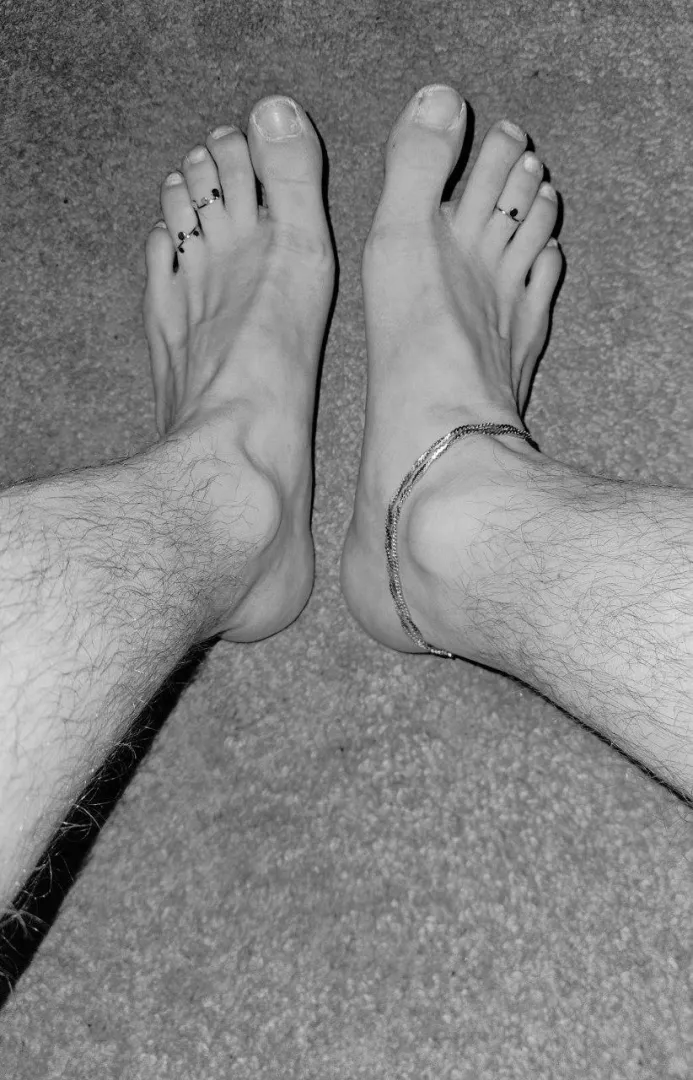 I love toe rings posted by PickAdministrative15