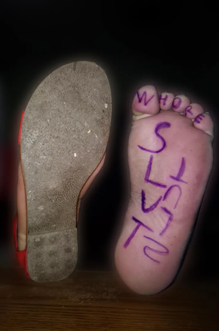 I love using my dead foot to express how I feel or what I am ♥️ posted by Elegant-Morning-8580