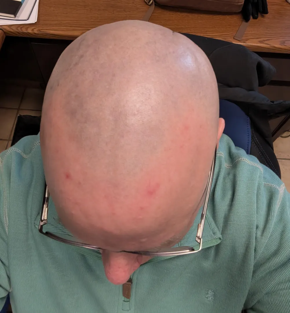 I need cum and piss on my bald head posted by bzzzmetndr