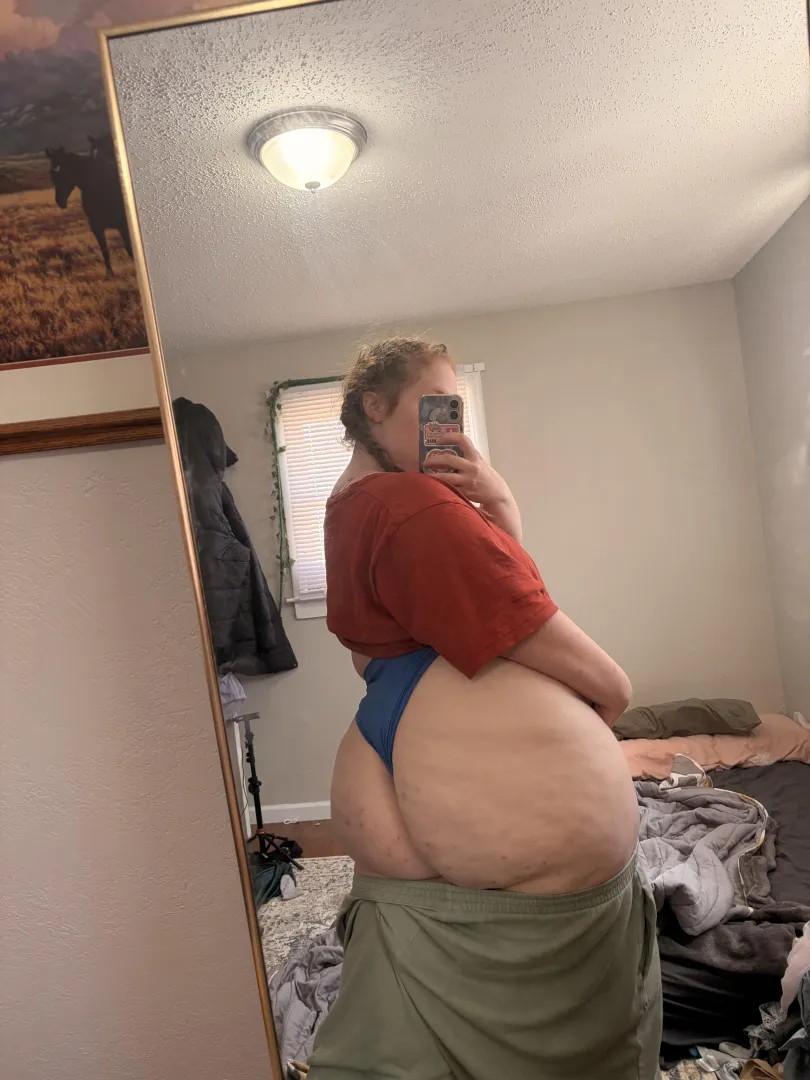 I put moderate, but would you call this extreme, or moderate, or light cellulite, I’m curious what you guys think posted by No-Scarcity5784