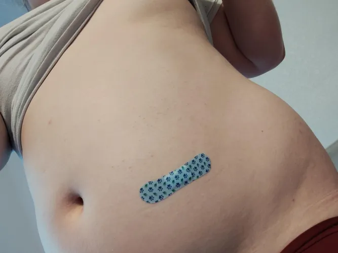 I started injections today  by petrafiedpaws