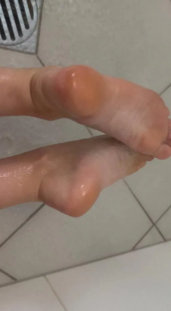 I think you should rub them posted by NyxWitchingHour