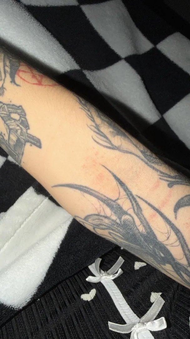 I'm new to trying latex and got these chafing marks. posted by abdulgoth666