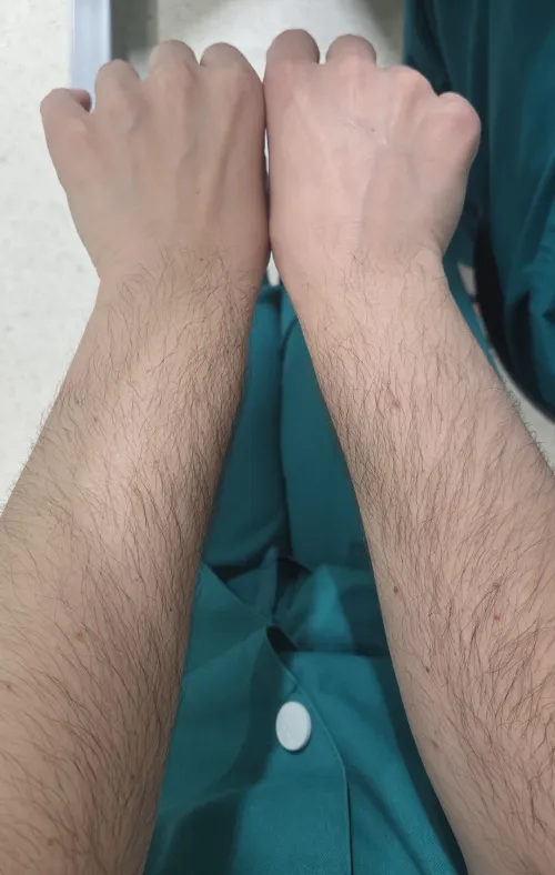 I'm your hairy nurse ❤️ [arms] by ssakkuraa