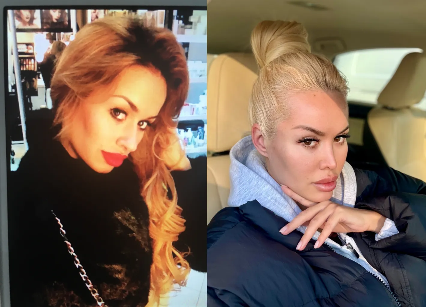 In the my “before” life, I always used lip gloss to make my lips look bigger without fillers posted by CaseySoda