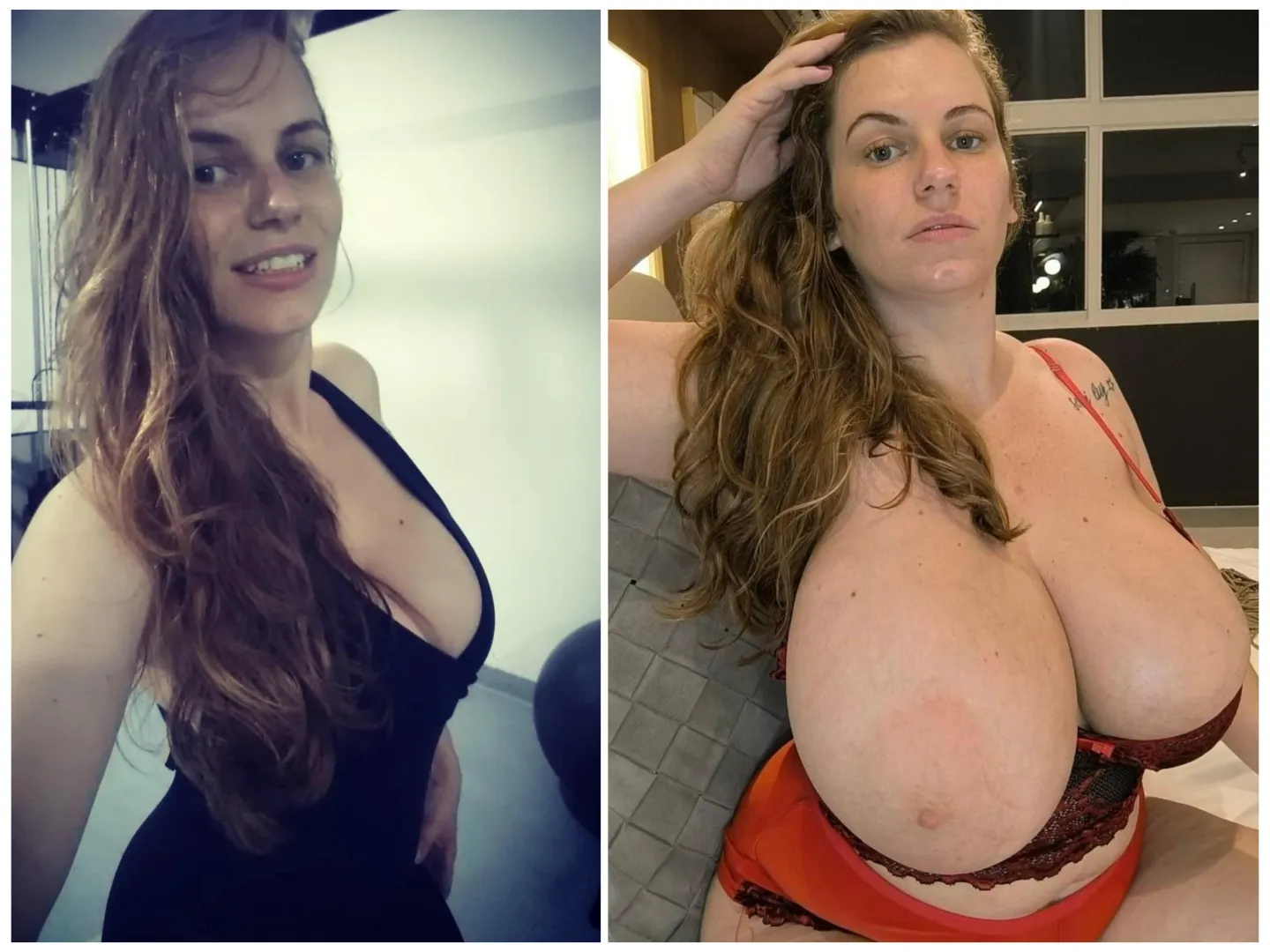 Incredible breast growth posted by RandyLahey993