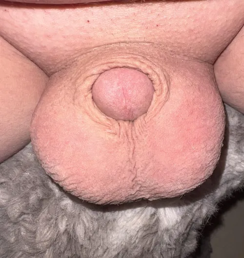 Innie (40) by Odd-Elk-8221