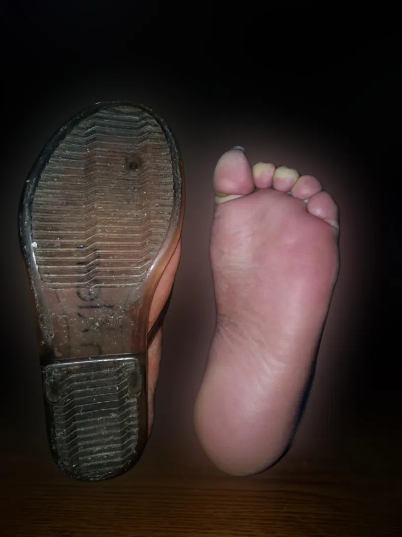 Is it a turn off that my left foot/leg are completely paralyzed and numb? posted by Elegant-Morning-8580