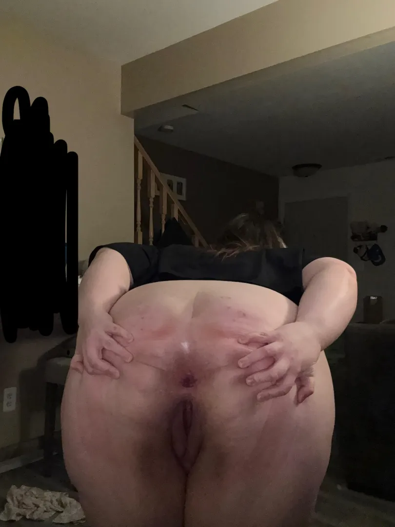 Is my asshole pretty? posted by oleHyena