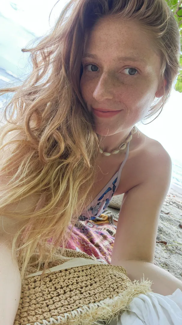 it's always freckle season somewhere posted by freedom_fruit