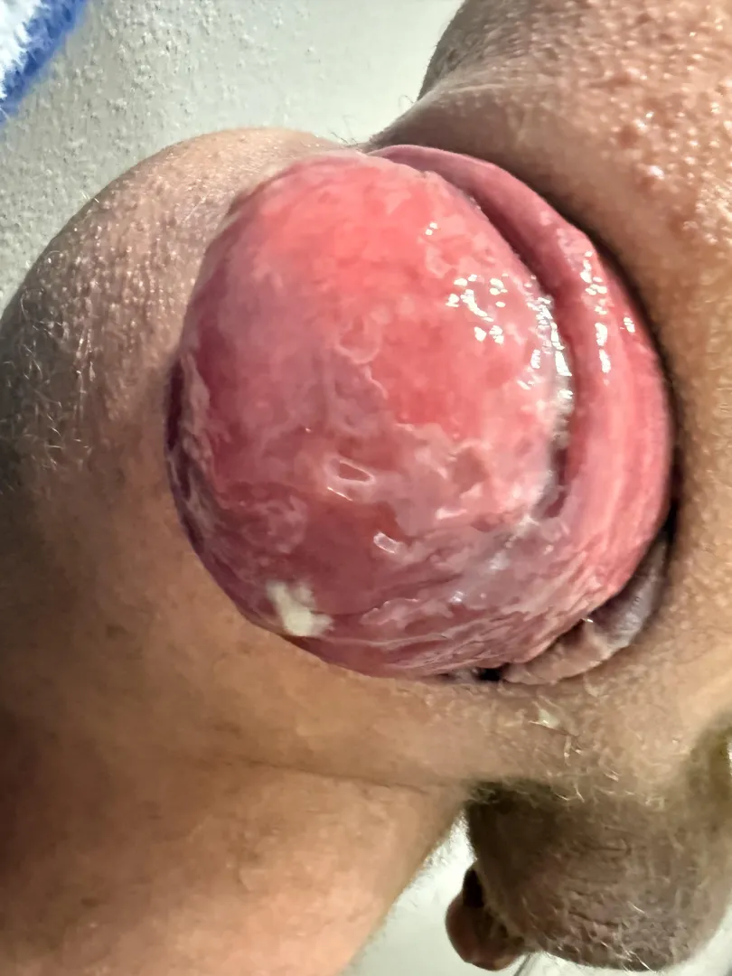 Its getting so round posted by ThePrepGod